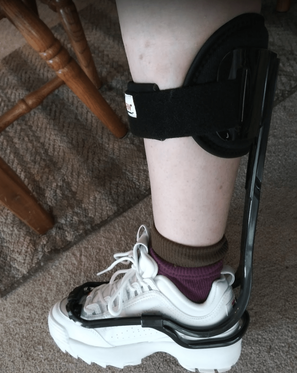 Woman's leg wearing a TurboMed AFO