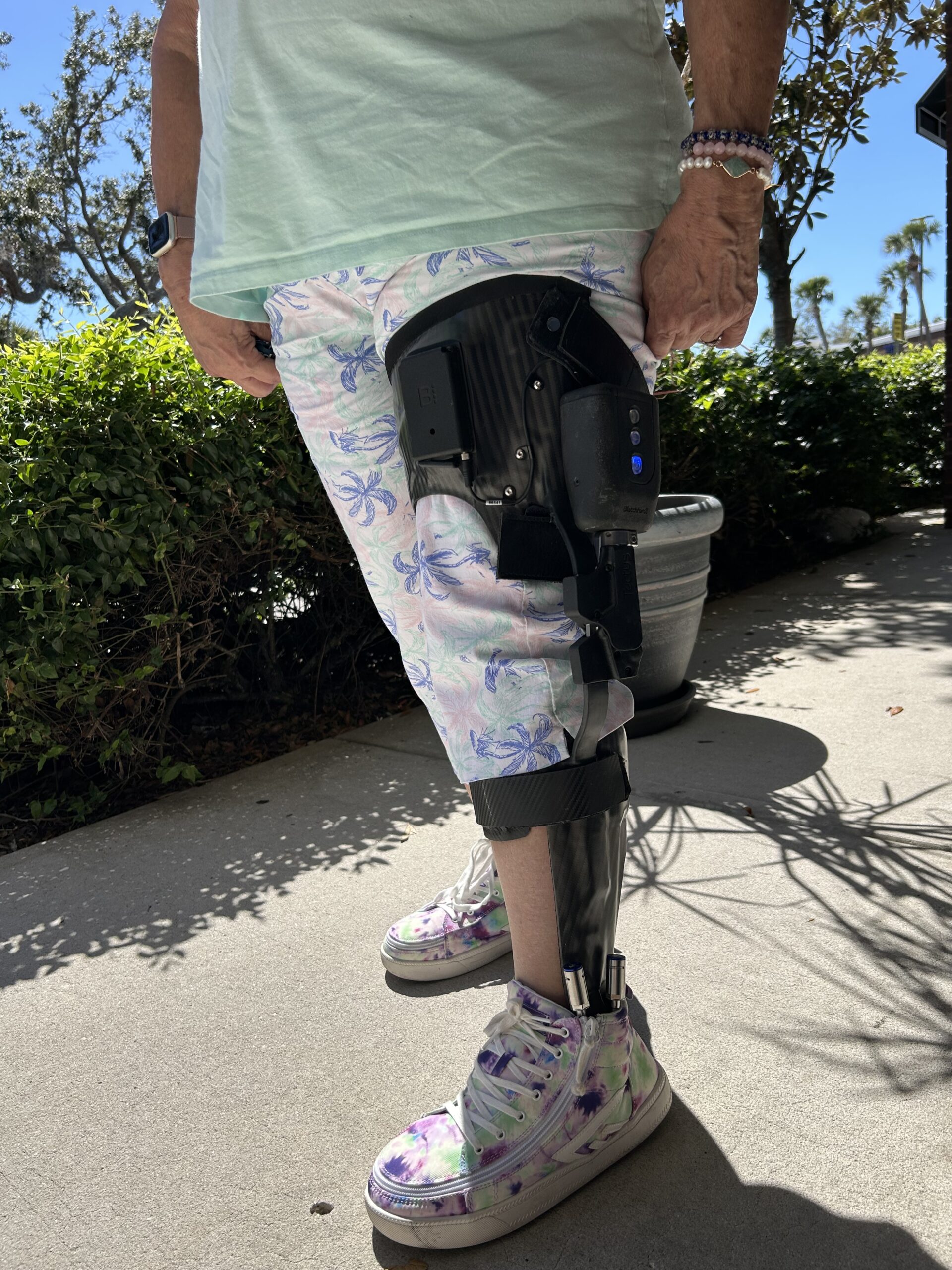Close up of a woman's leg wearing white and floral patterned capri pants and a black Tectus microprocessor leg brace that goes from hip to foot.